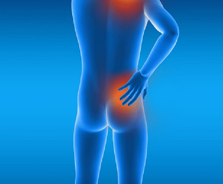 Dolor lumbar